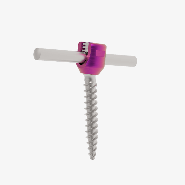 GREENS Innilock Single Thread Polyaxial Screw